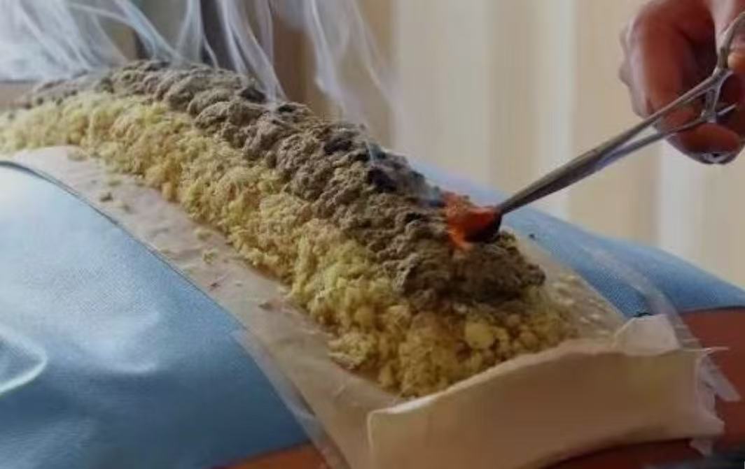 督脉灸