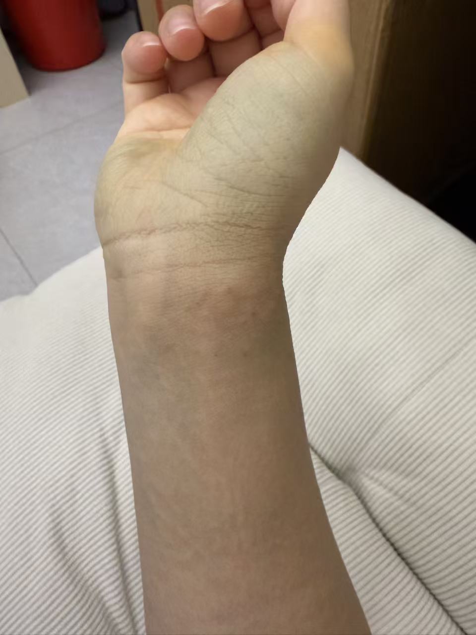 运动拉伤