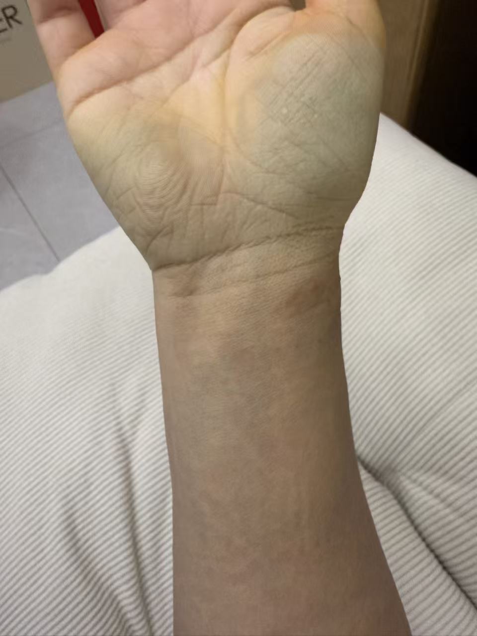 运动拉伤